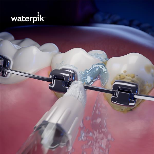 Orthodontic Tip OD-100E | Replacement Tips - Image 3