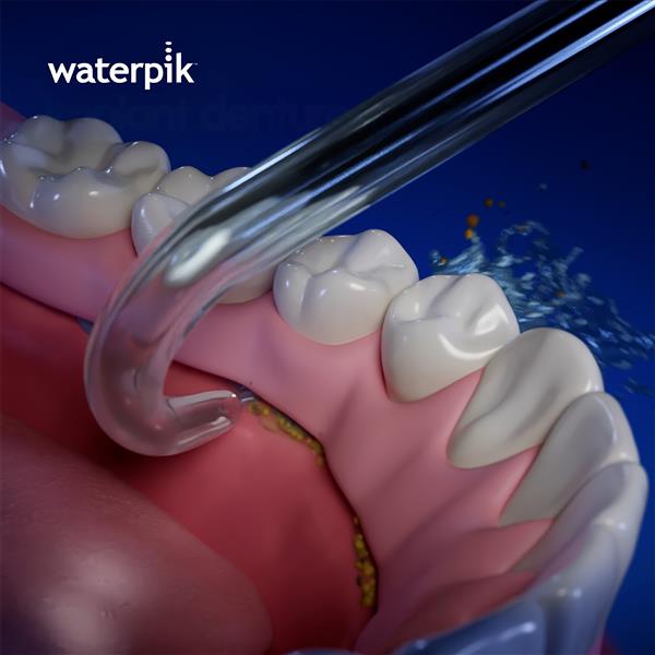 Implant Denture Tip DT-100E | Replacement Tips - Image 3
